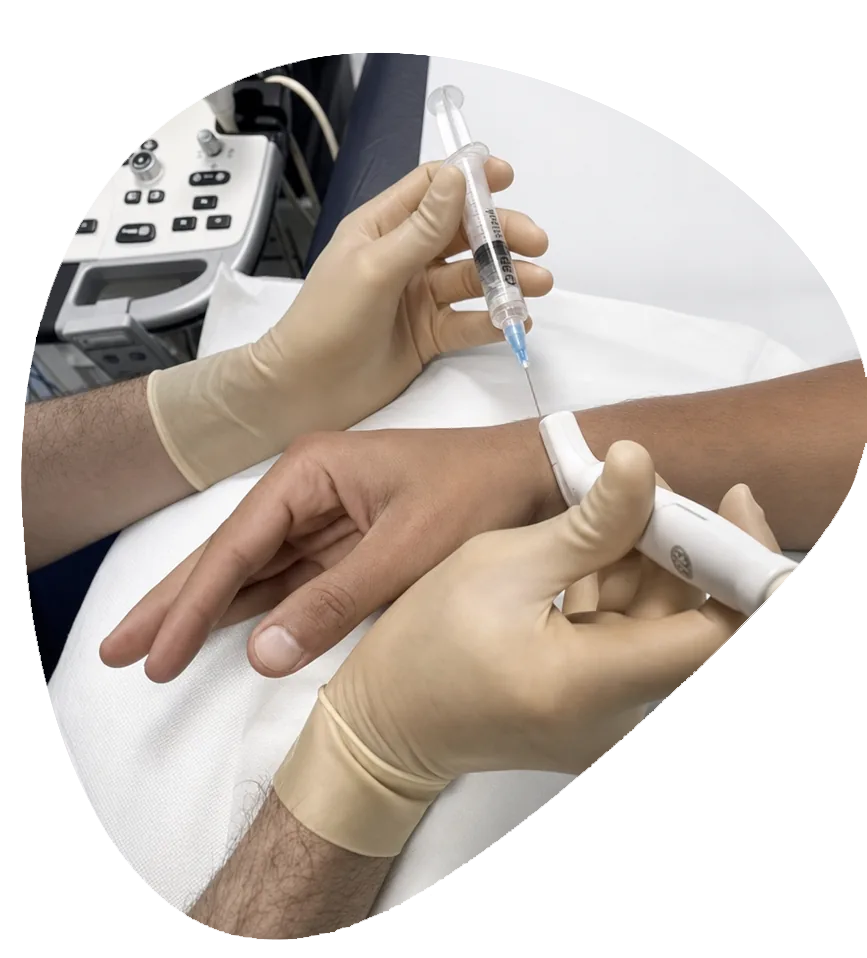Carpal Tunnel Steroid Injections