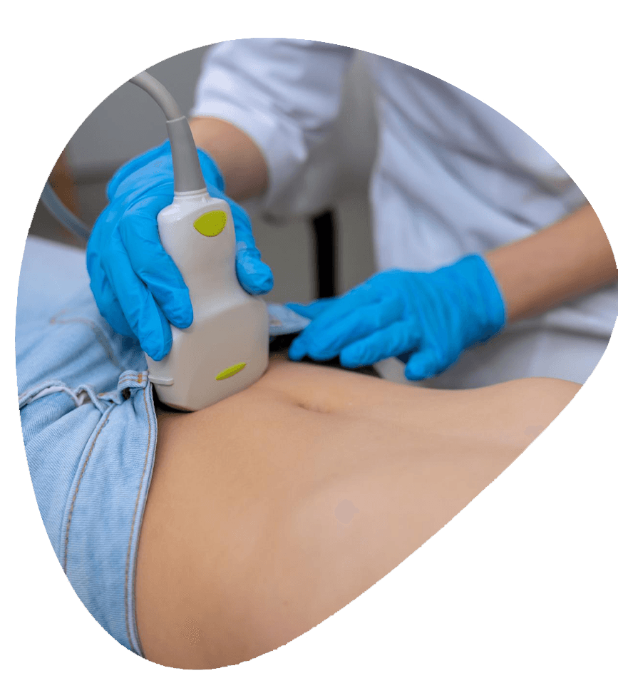 Fibroid Ultrasound