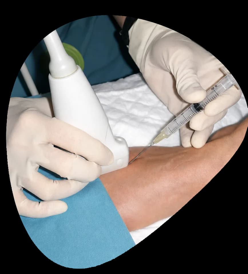 Morton’s Neuroma Injections