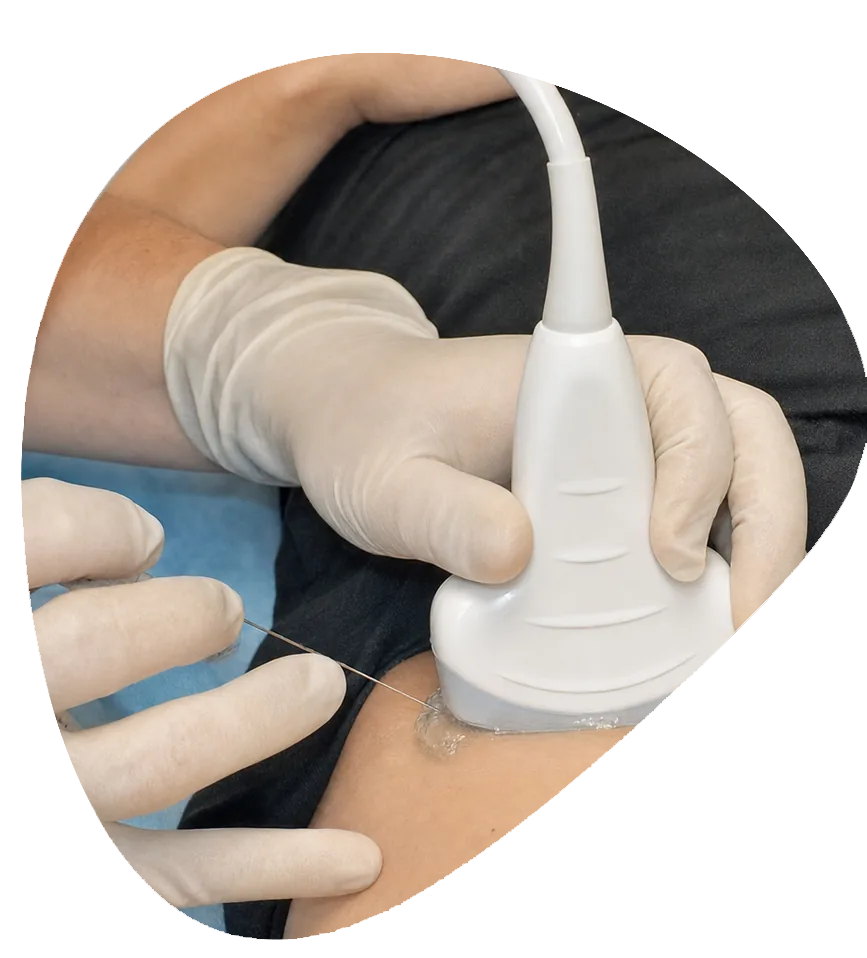 Hip Steroid Injections