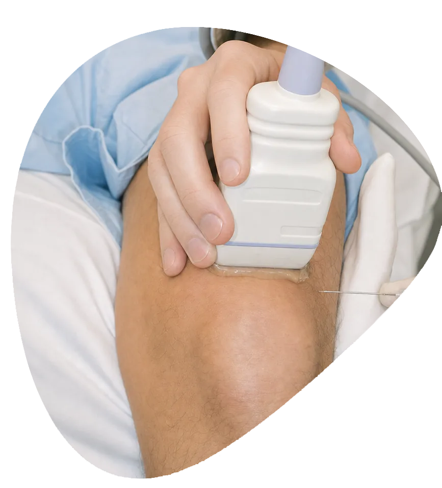 Knee Steroid Injections