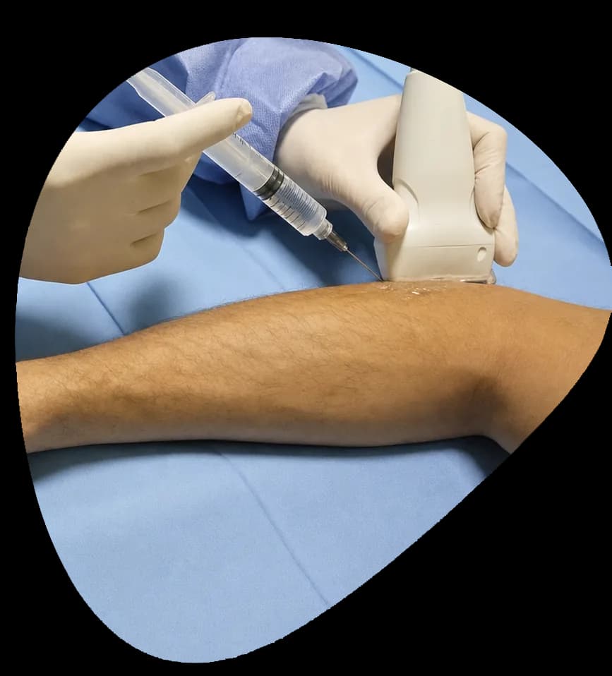 Tennis Elbow Injections