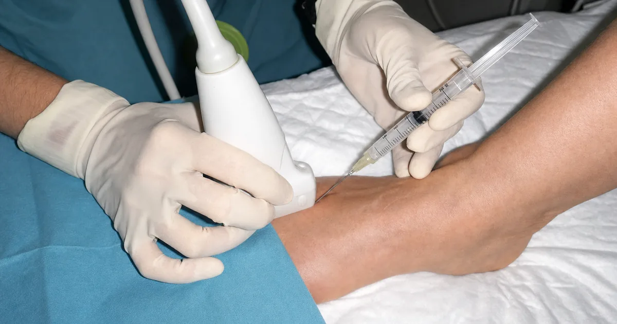 b12 injection for mortons neuroma Morton's Steroid London Backorder